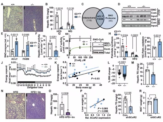 Sci Signaling：脂肪代谢“总开关”找到！抑制 SCoR2 酶，既阻脂肪合成又促燃烧，为肥胖治疗开辟新路径