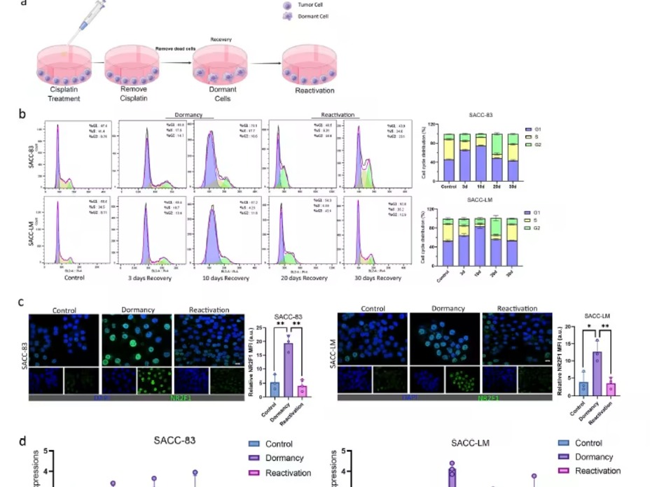 破解潜伏癌细胞的“唤醒密码”！Exp Mol Med：CAF-EVs携PLIN2驱动脂质自噬促使唾液腺癌复发