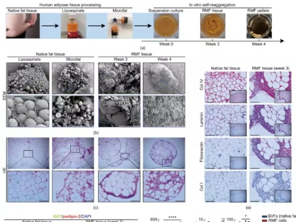 脂肪变“器官”！上海交大团队突破再生医学，脂肪组织直接培育三类功能类器官